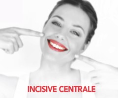 Incisive centrale : restauration et esthétique